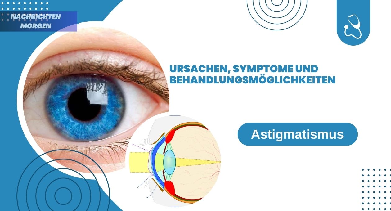 Astigmatismus Ursachen Symptome und Behandlungsmöglichkeiten