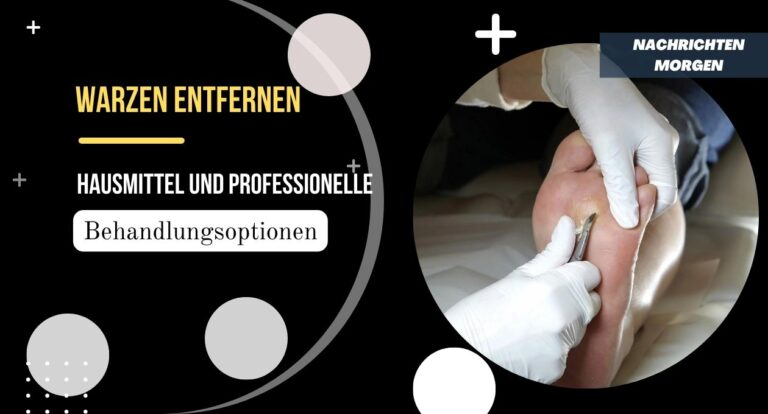 Warzen Entfernen