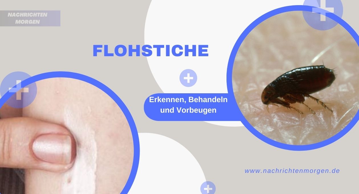 Flohstiche