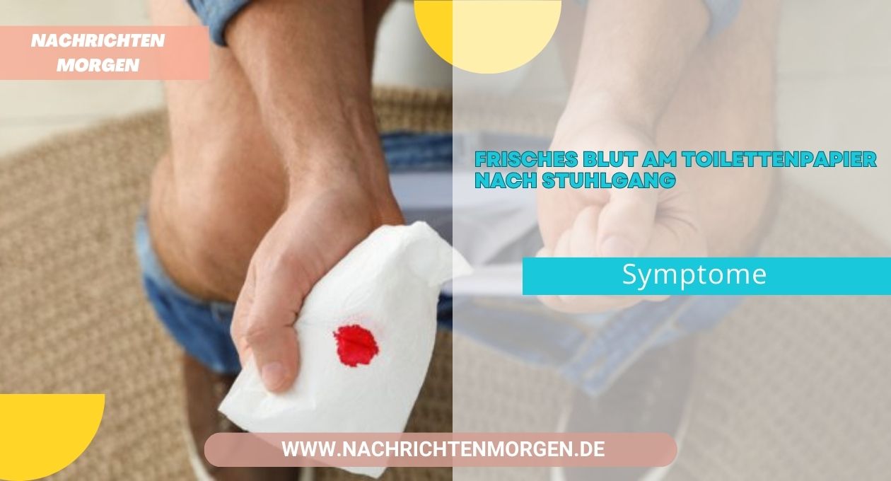 Frisches Blut Am Toilettenpapier Nach Stuhlgang