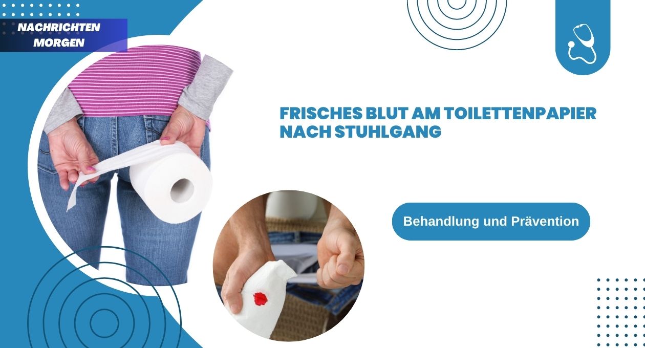 Frisches Blut Am Toilettenpapier Nach Stuhlgang