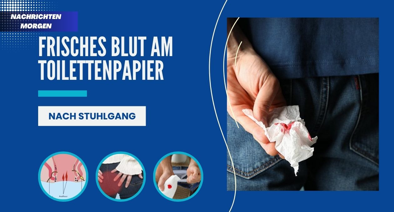 Frisches Blut Am Toilettenpapier Nach Stuhlgang