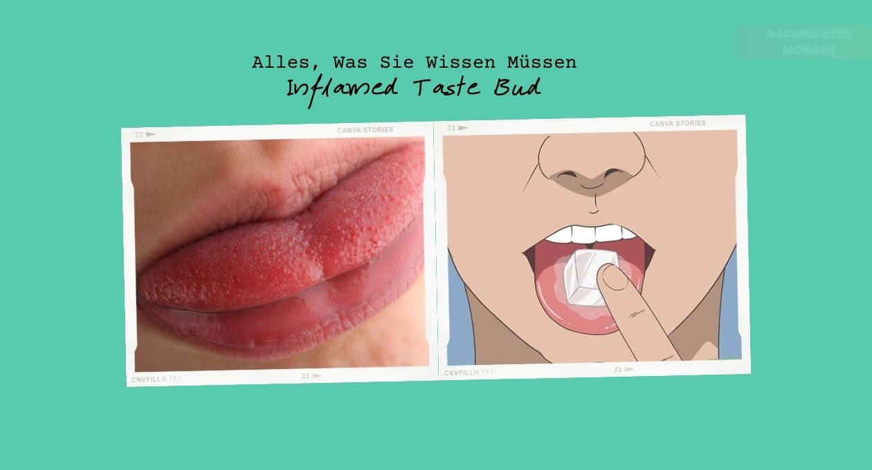 Inflamed Taste Bud