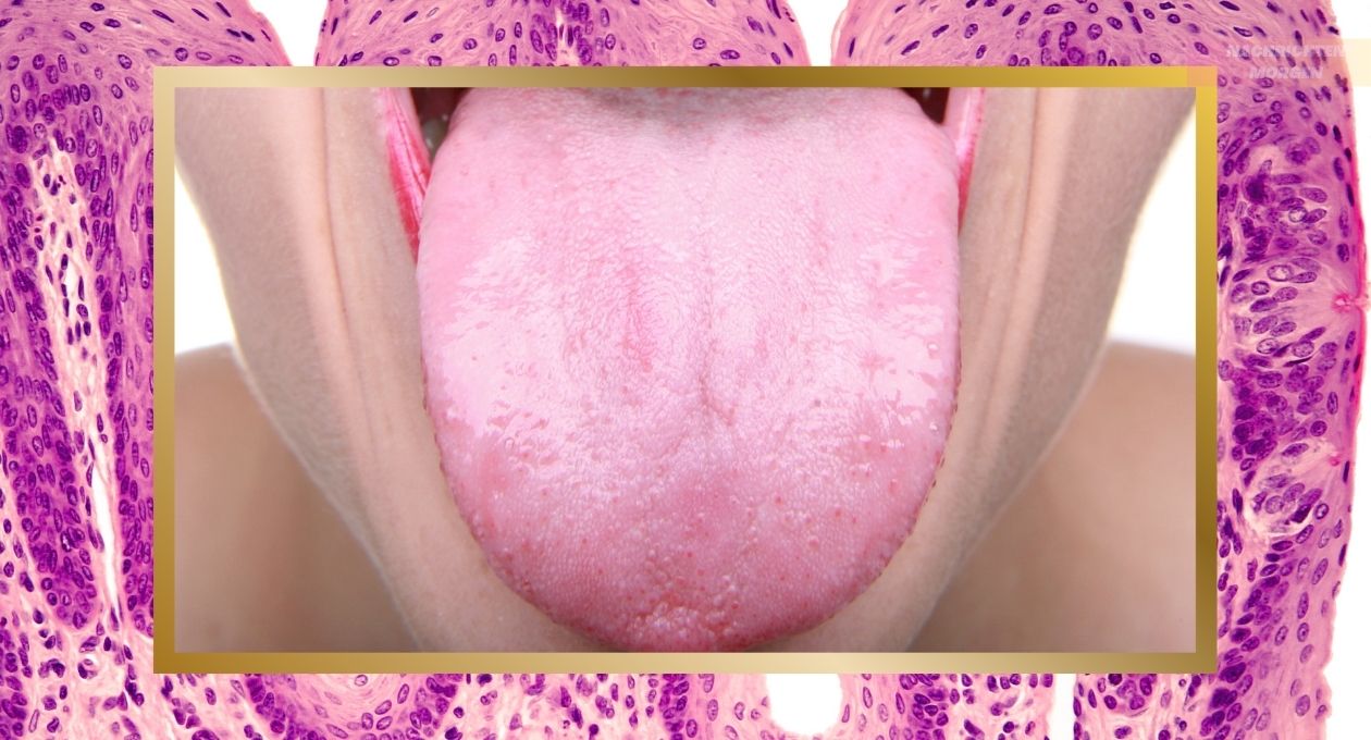 Inflamed Taste Bud