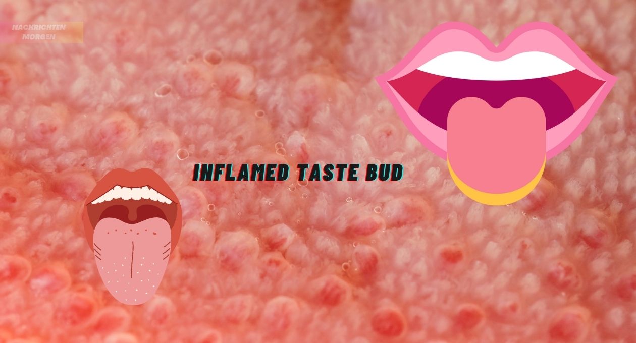 Inflamed Taste Bud