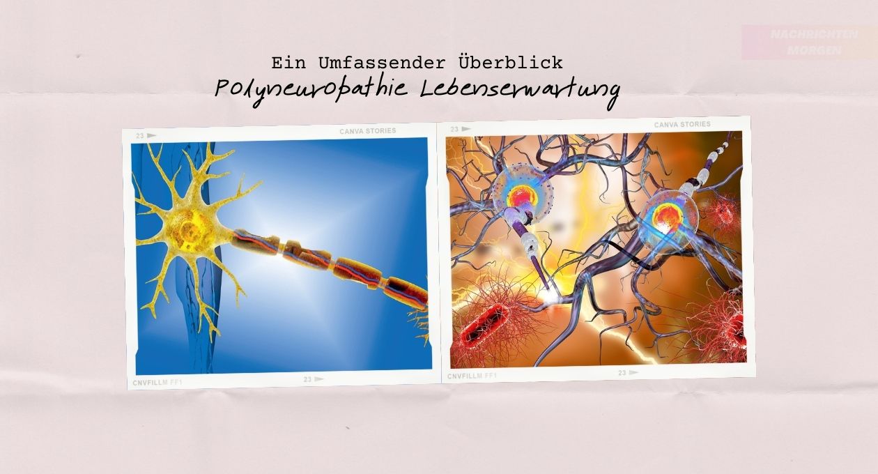 Polyneuropathie Lebenserwartung