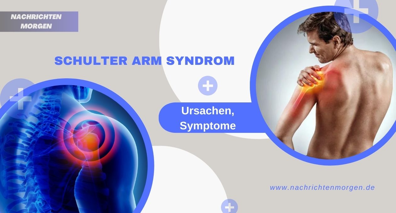 Schulter Arm Syndrom