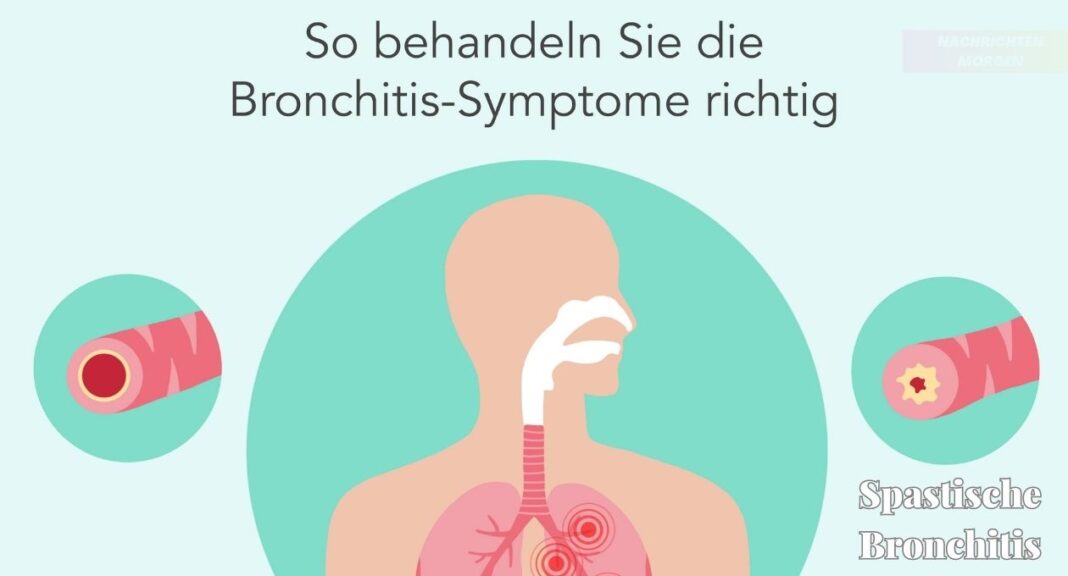 Spastische Bronchitis: Symptome, Ansteckung und Behandlung