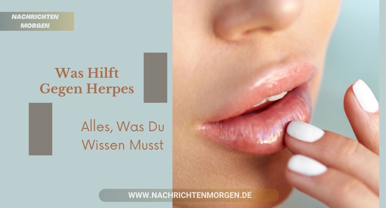 Was Hilft Gegen Herpes