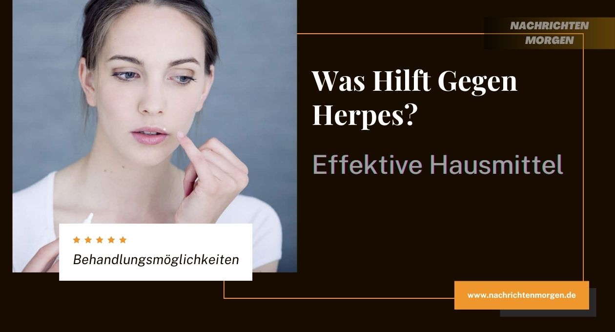Was Hilft Gegen Herpes