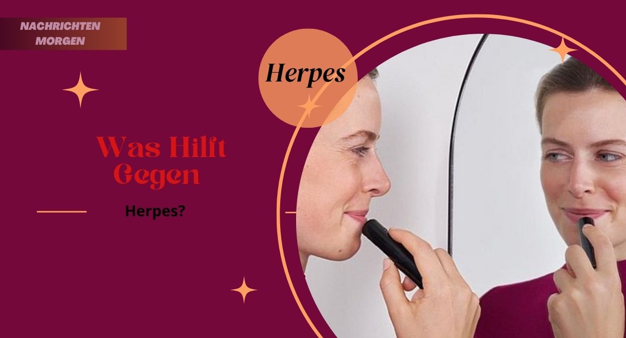 Was Hilft Gegen Herpes