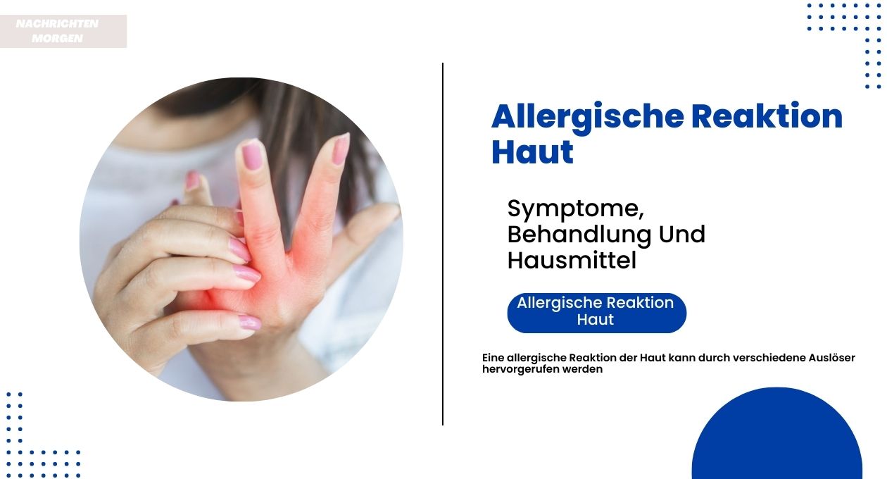 allergische reaktion haut