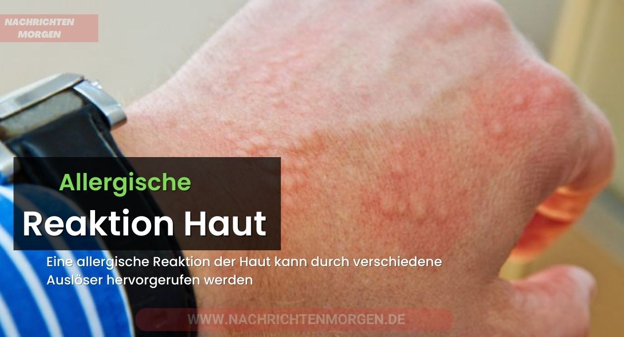 allergische reaktion haut