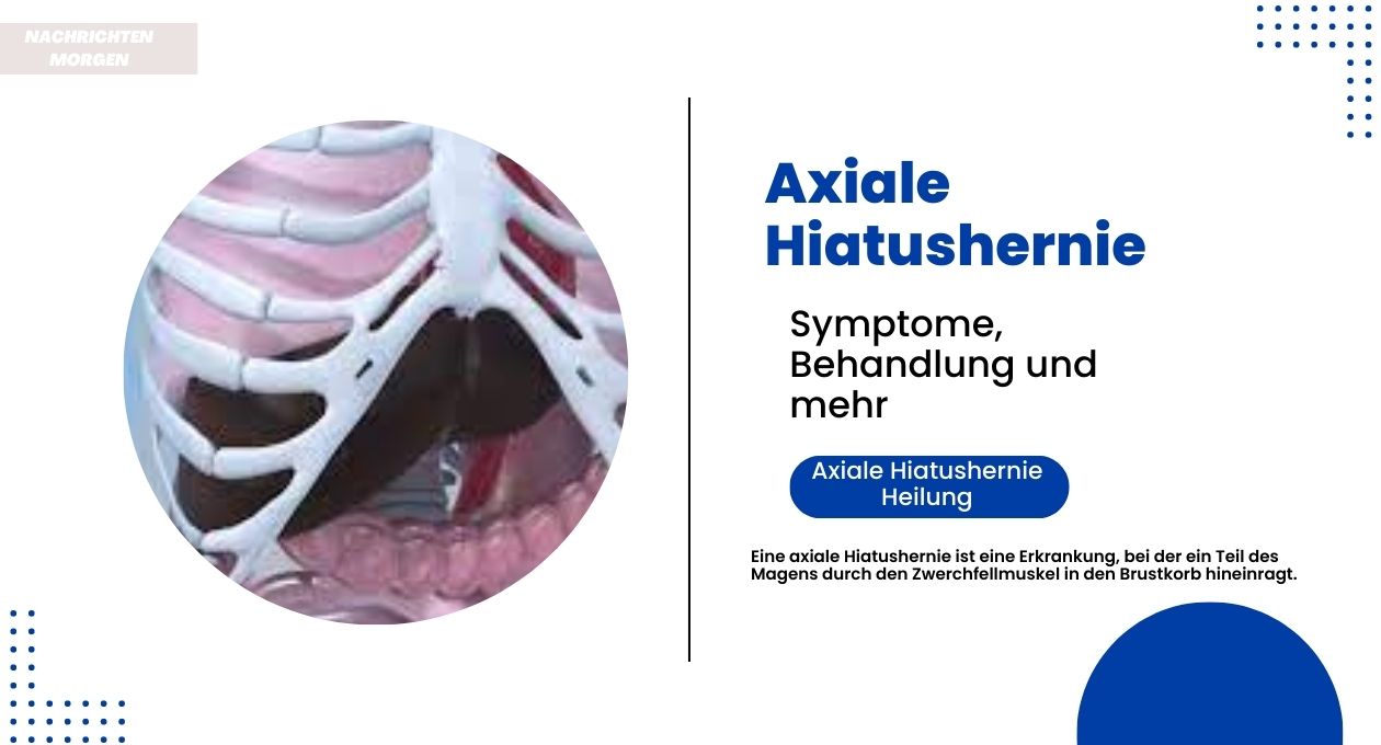 axiale hiatushernie