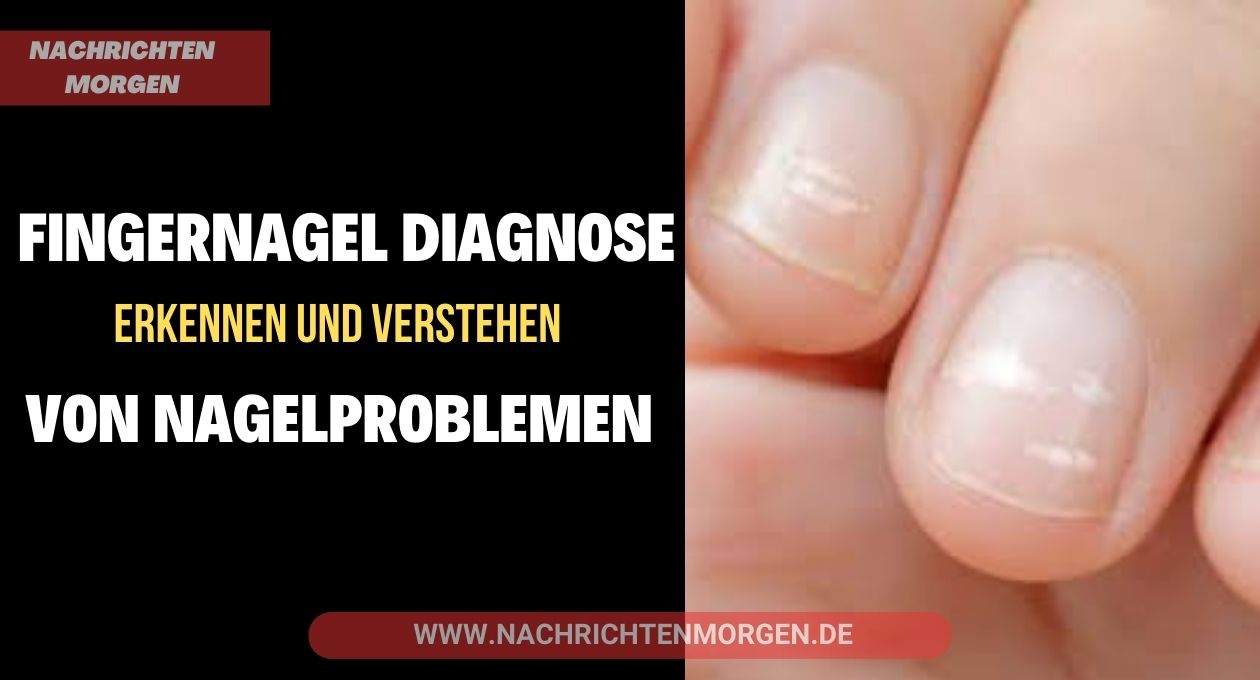 fingernagel diagnose bilder