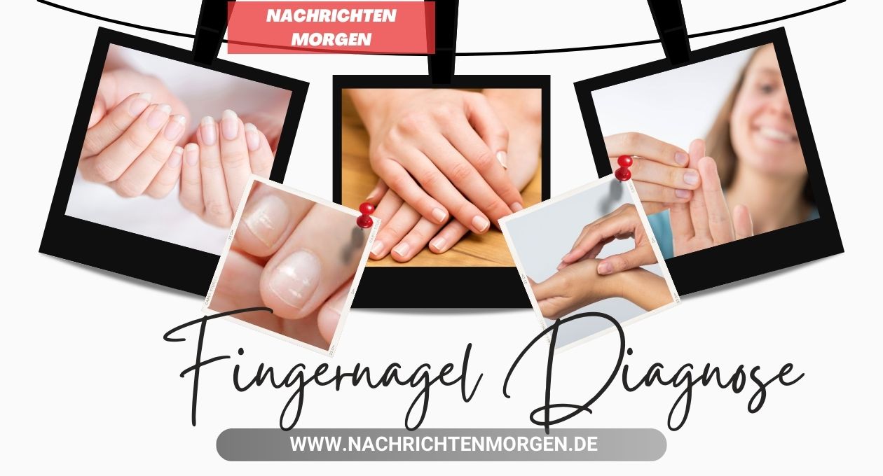 fingernagel diagnose bilder