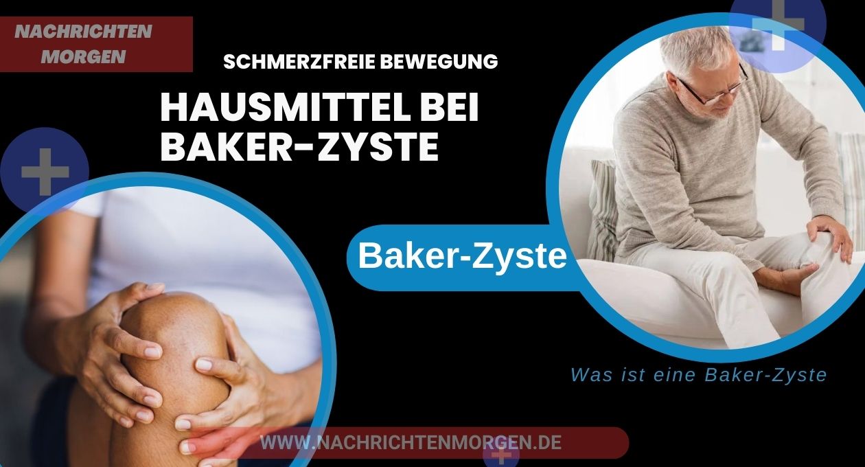 hausmittel bei baker-zyste