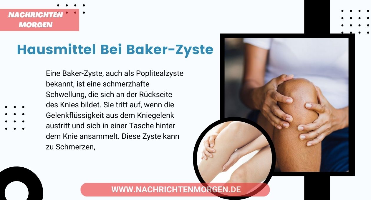 hausmittel bei baker-zyste