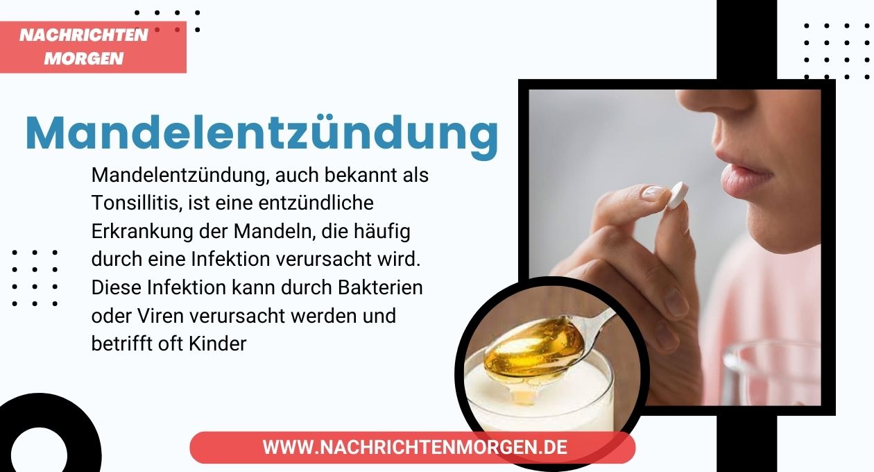 mandelentzündung