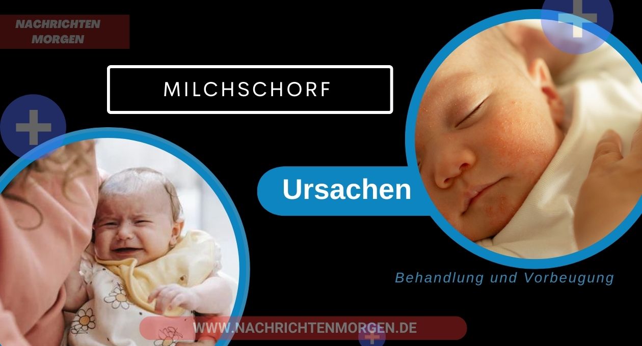 milchschorf