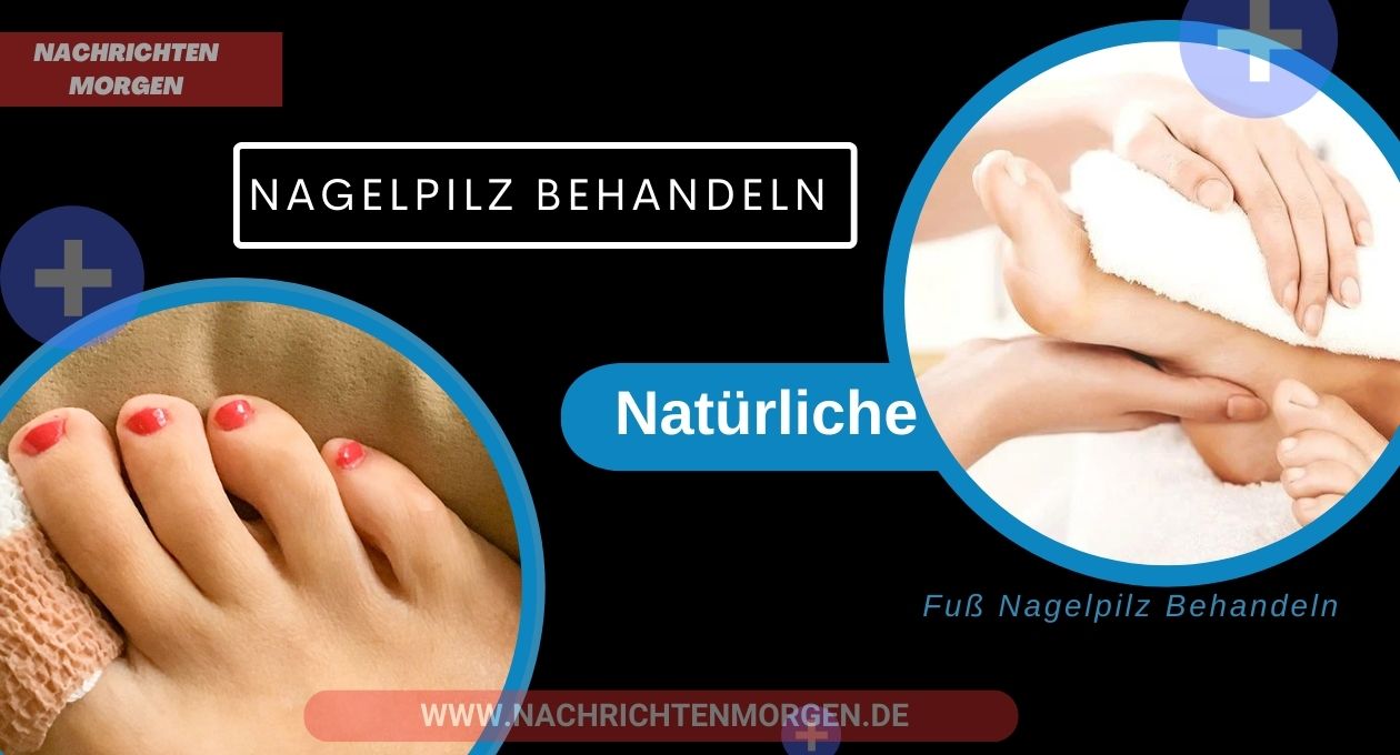 nagelpilz behandeln