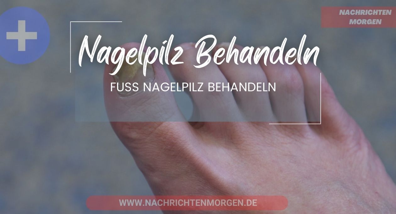 nagelpilz behandeln