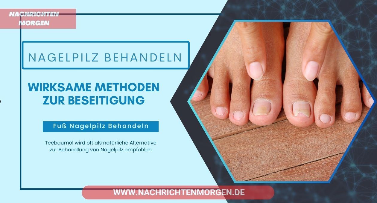 nagelpilz behandeln