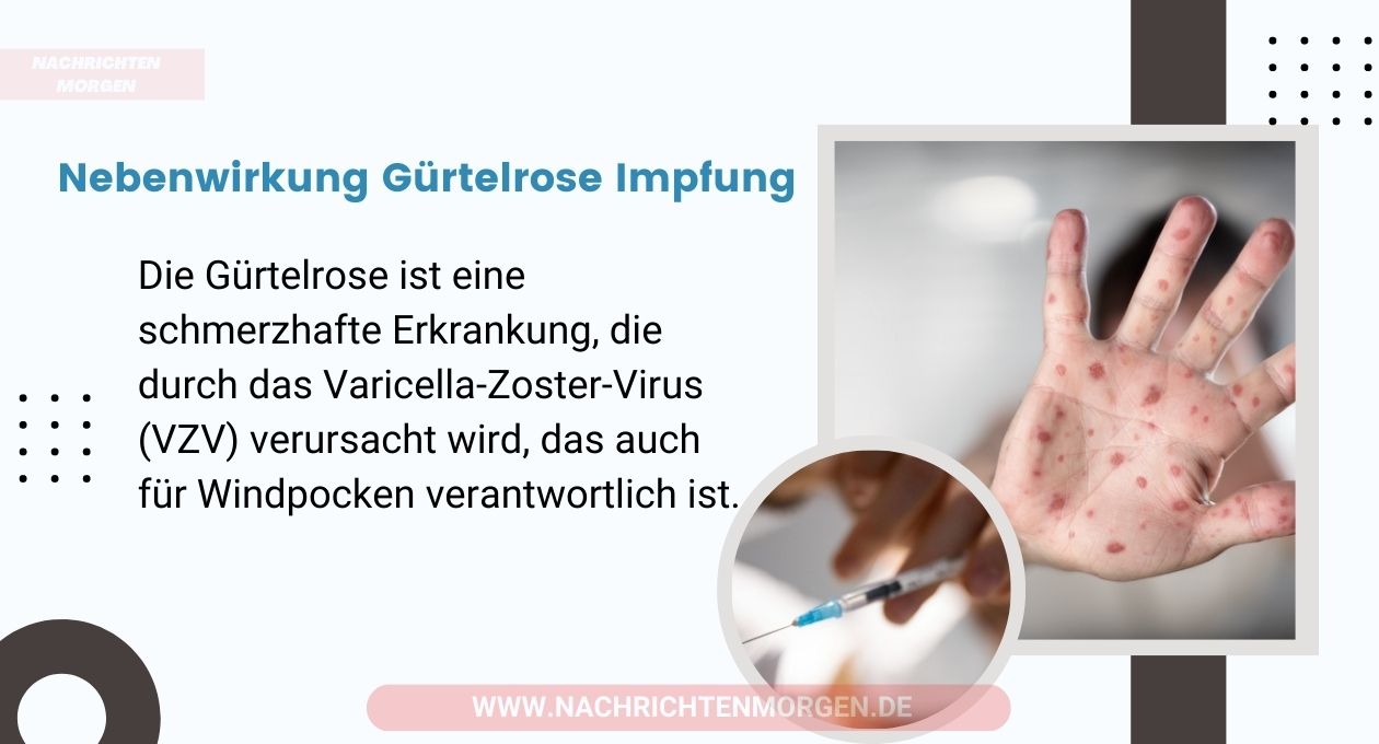 nebenwirkung gürtelrose impfung