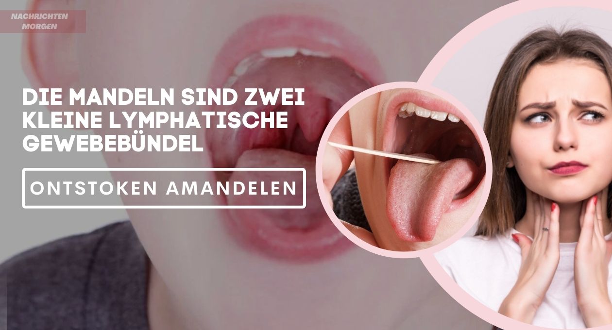 symptomen ontstoken amandelen