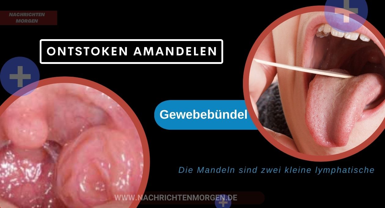 symptomen ontstoken amandelen