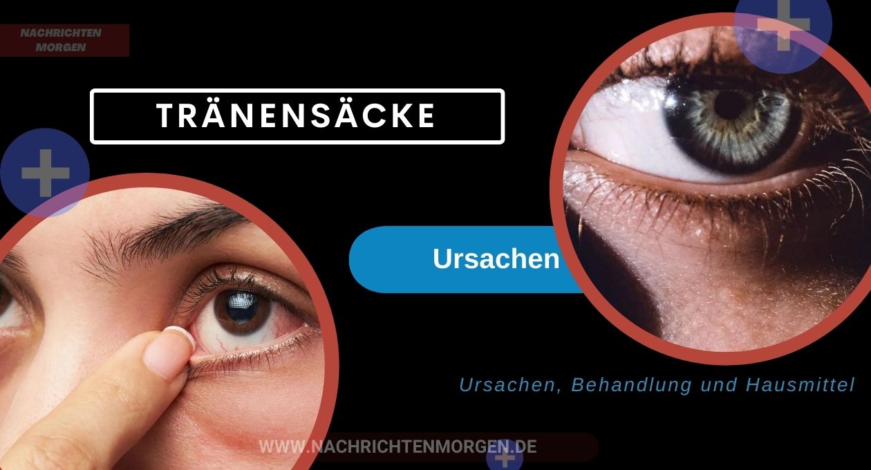 tränensäcke