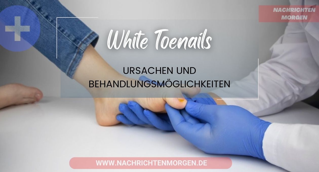 white toenails