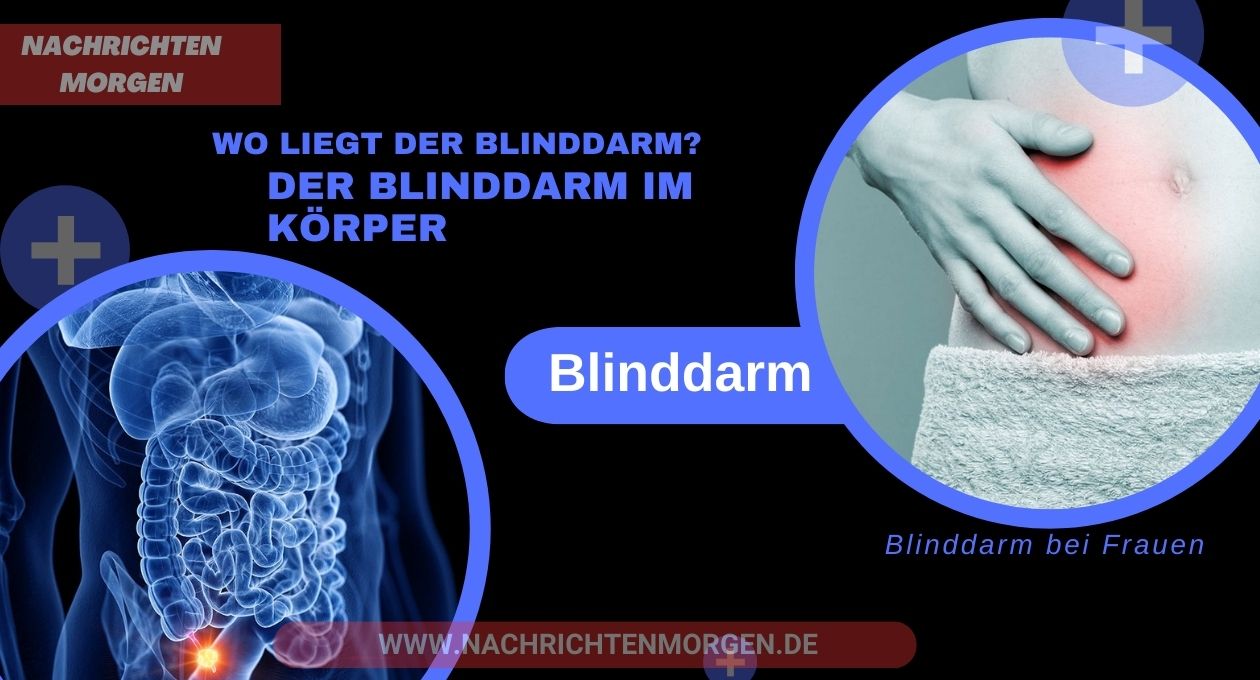 wo liegt der blinddarm