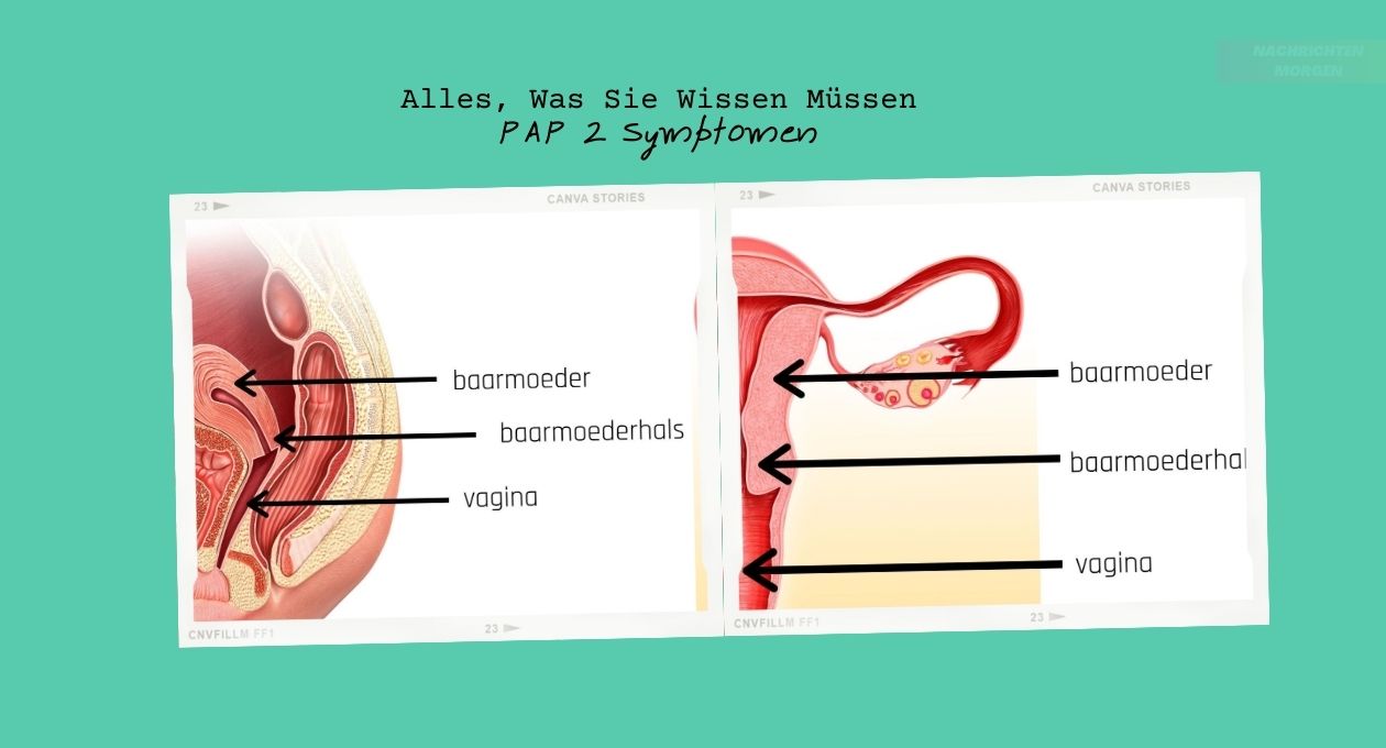 PAP 2 Symptomen 