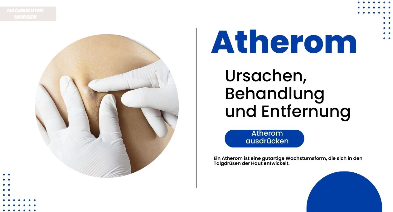 atherom