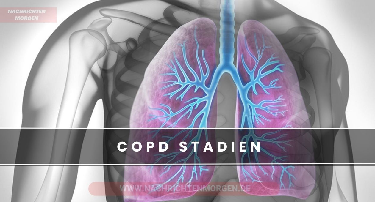 copd stadien