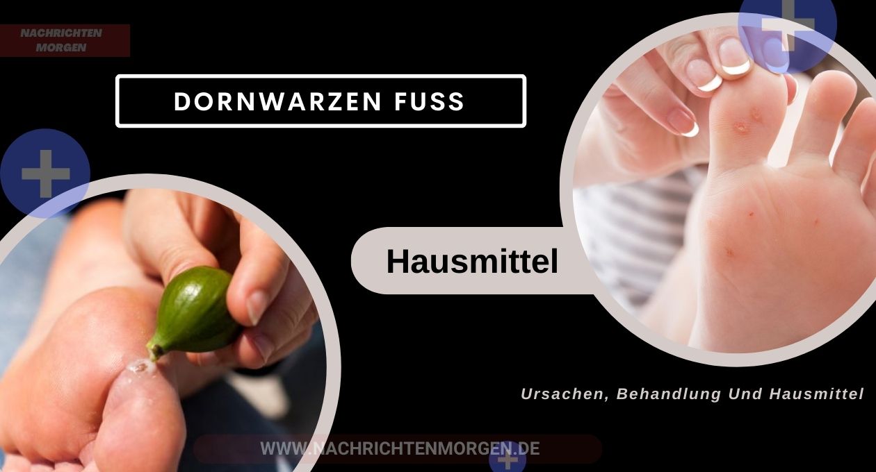 dornwarzen fuß