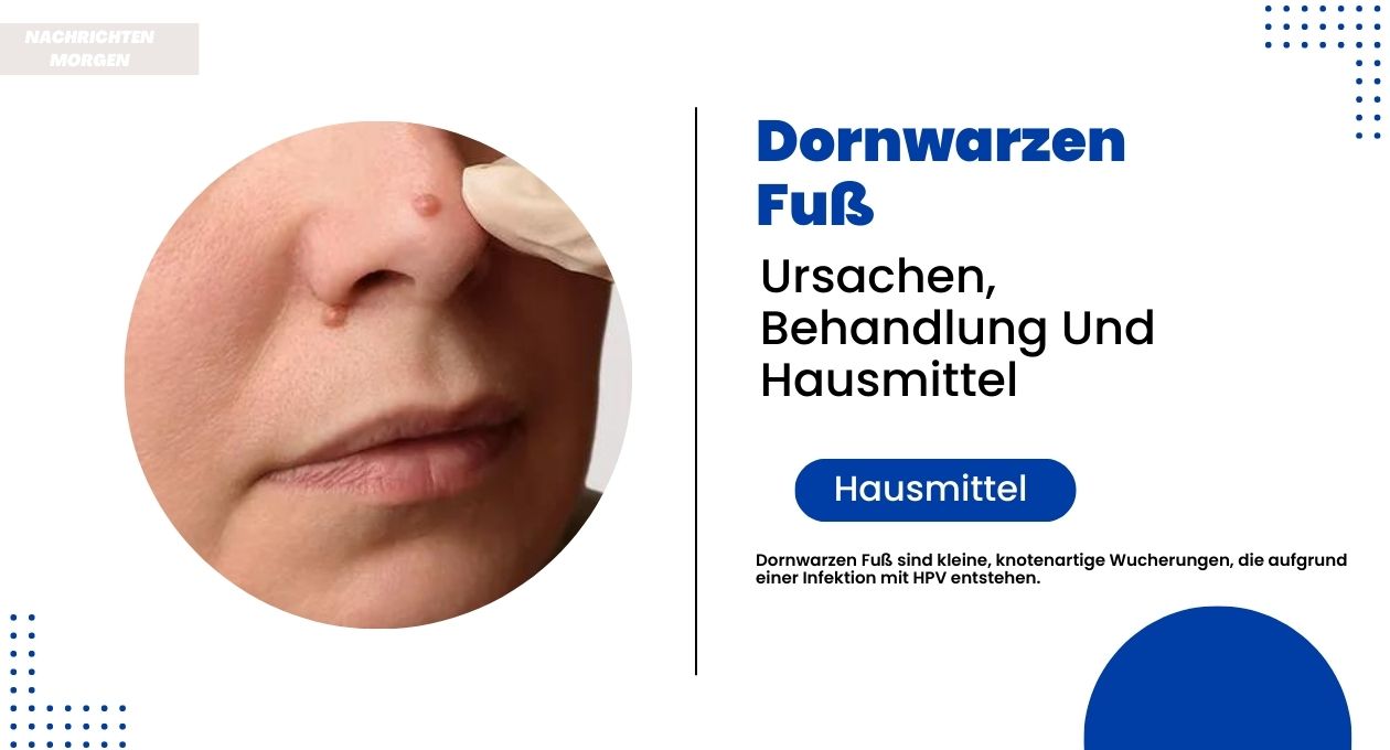 dornwarzen fuß