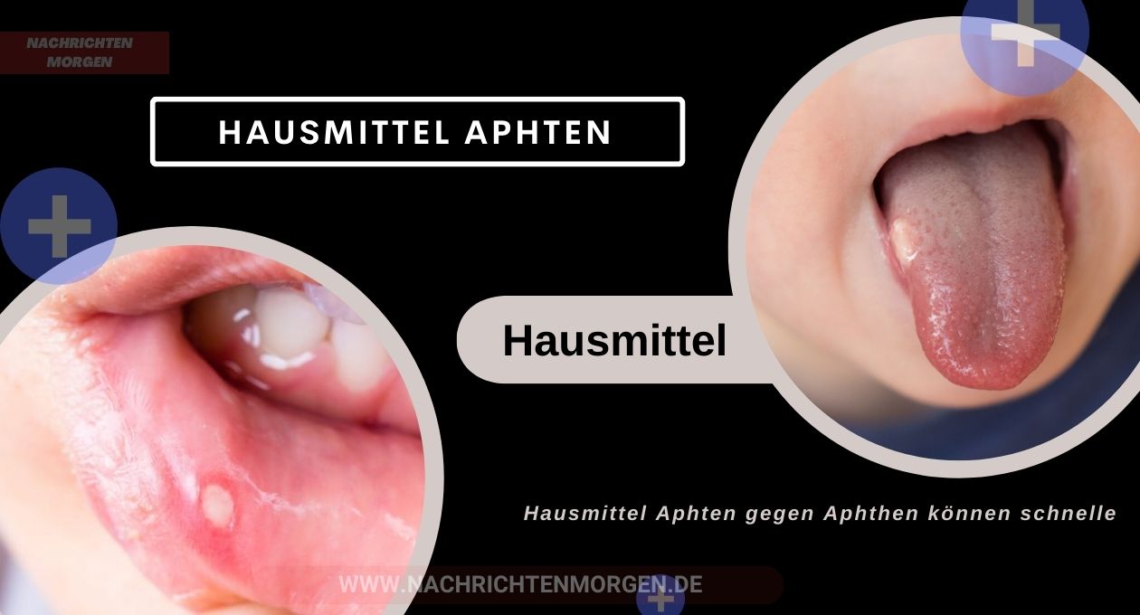 hausmittel aphten