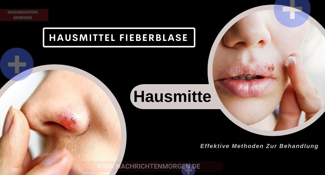 hausmittel fieberblase