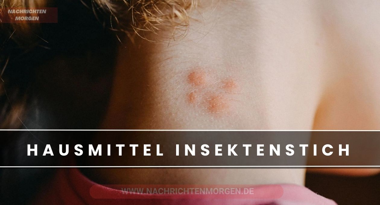 hausmittel insektenstich