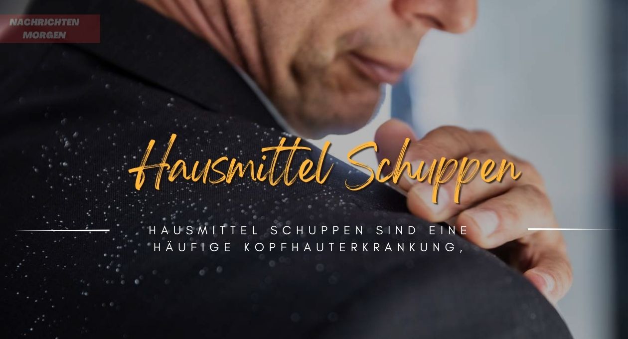 hausmittel schuppen