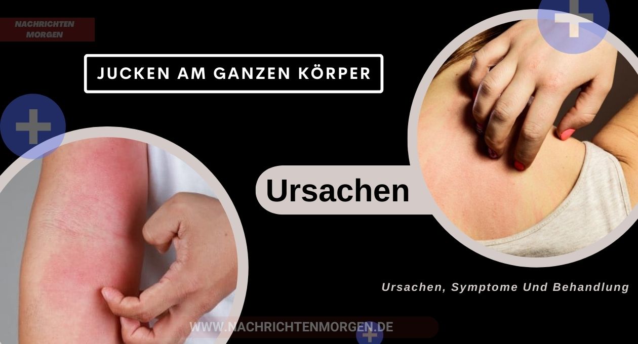 jucken am ganzen körper