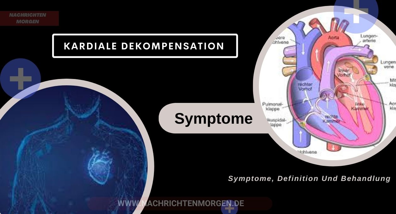 kardiale dekompensation