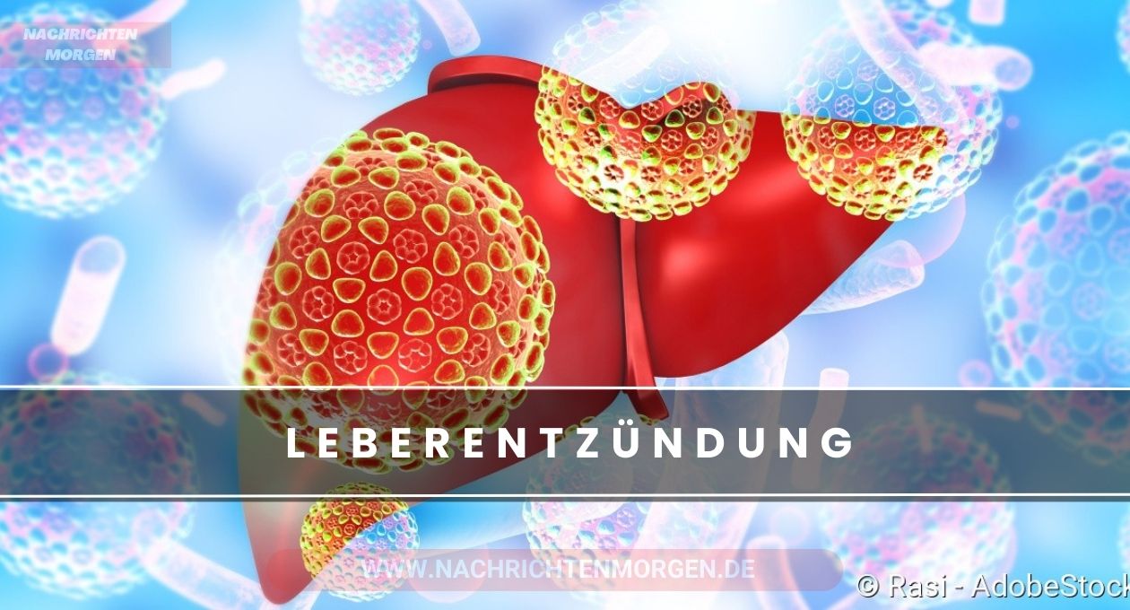 leberentzündung