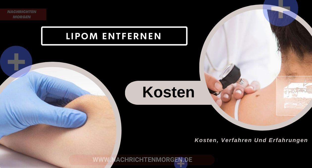 lipom entfernen