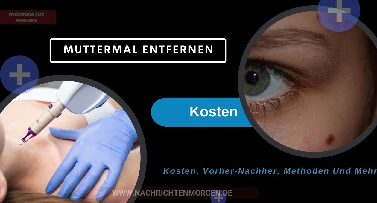 muttermal entfernen