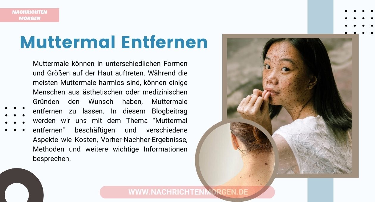 muttermal entfernen