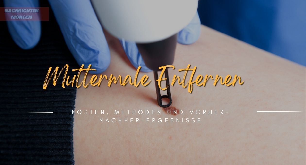 muttermale entfernen