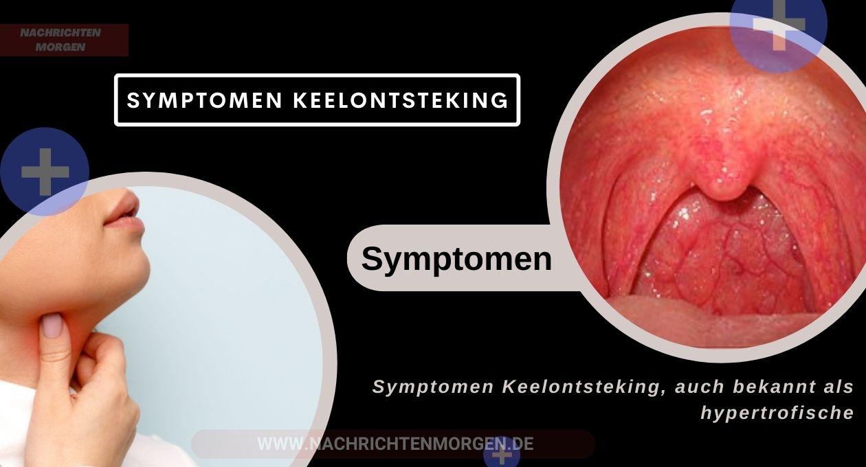 symptomen keelontsteking